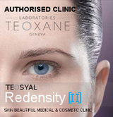 Tear trough fillers. Skin Beautiful is a Teosyal Redensity II authorised clinic