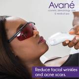New Album of Avane Clinic - Skin Laser Treatment