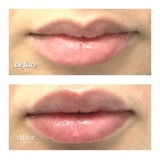 Profile Photos of Oxygen & Deep Cleaning Facial