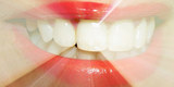 Want a dazzling smile? Check out our dental directory to find the best dentists in your area!

https://www.torontodentistdirectory.com/