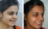 New Album of The Prefect Smile Dental Clinic, Chandigarh