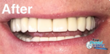 Profile Photos of Top Dental Care