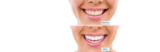 Profile Photos of Bliss Dental - General Dentist specializing in Veneers, Smile Makeover