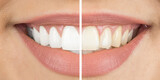 OUR COSMETIC DENTISTRY SERVICES CAN HELP YOU FEEL SELF-ASSURED AND CONFIDENT EVERY TIME YOU SMILE.

