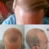 Profile Photos of Hair Repair Cancun.