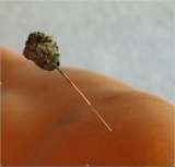 moxa herb is put on the needle to strengthen the effect by warming the acupuncture channel