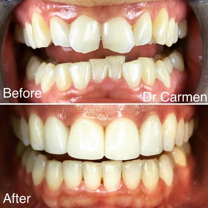  Profile Photos of Dr Carmen Wilsenach Aesthetic Dentistry Practice 26 Bompas Rd, Dunkeld West - Photo 2 of 8