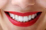 7/16/12 Daily Dose Kotz  blog about whiter teeth