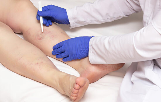 Laser Vein Removal Services of Wellsprings Medical Spa 11685 Yonge Street, Unit 101A & 102A - Photo 3 of 4