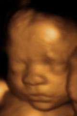 New Album of BabyView 3D Prenatal Imaging Ultrasounds