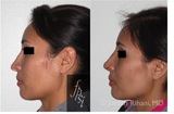 Profile Photos of Facial Plastic Surgery Institute