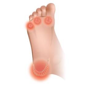 calluses Profile Photos of Foot Solutions - Best Comfortable Shoes 2317-C Forest Drive - Photo 9 of 12