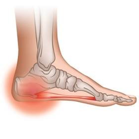 heel spurs Profile Photos of Foot Solutions - Best Comfortable Shoes 2317-C Forest Drive - Photo 10 of 12