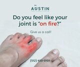 Do you feel like your joint is on fire? Call your Austin foot specialist about arthritis. https://austin-footdoctor.blogspot.com<br />
 Austin Foot & Ankle Center 9012 Research Blvd #C13 