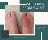 Suffering from gout? This type of arthritis can cause abrupt, severe attacks of ache, swelling, redness and tenderness, often in the big toe. https://austin-footdoctor.blogspot.com<br />
<br />
 Austin Foot & Ankle Center 9012 Research Blvd #C13 