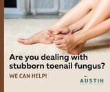 <br />
<br />
Toenail fungus is a common infection on the nail, and it can be challenging to get rid of. You might suffer from toenail fungus if you have noticed yellowish, thickened, brittle, crumbly, or ragged nails. <br />
https://www.facebook.com/austinfootandanklec Austin Foot & Ankle Center 9012 Research Blvd #C13 