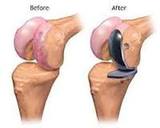 Profile Photos of Elbow Surgery Ghaziabad