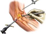 Profile Photos of Elbow Surgery Ghaziabad