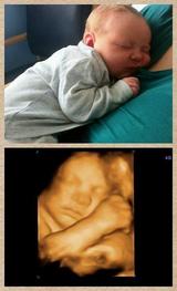 Profile Photos of Private Gender and 4D Baby Scan Surrey - Window to the Womb