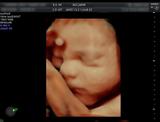 Profile Photos of Private Gender and 4D Baby Scan Surrey - Window to the Womb