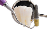 New Album of Dental Implant Professionals