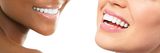 Teeth Whitening Media PA, LZ Bodak-Gyovai, DMD MSC PC, Media