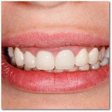 Profile Photos of Dr. Kemler Family Dentist