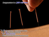 Cary NC Acupuncture Preston Chiropractic & Acupuncture 151 Quarrystone Circle, 116 
