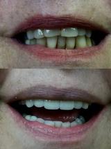 Profile Photos of Florida Dental Rejuvenation