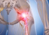 sciatica-nerve-treatment-alaska Better Health Chiropractic & Physical Rehab 8840 Old Seward Hwy Suite E 