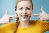 Dentist and orthodontist concept. Young woman teen girl smiling pointing with fingers on teeth with braces on blue