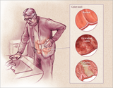 Gastroenterology Treatments of The Gastro Surgeon Chennai