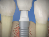 Profile Photos of Houston Dental Esthetics