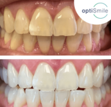 Profile Photos of OptiSmile Advanced Dentistry and Implant Centre
