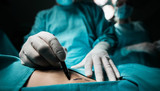 Close up of a plastic surgeon marking the human skin for surgery. 