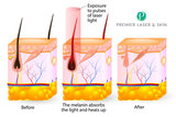Profile Photos of Premier Laser & Skin Clinic