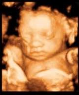  Love at First Sight 3D and 4D Ultrasound at Union Ultrasound, LLC 2333 Morris Avenue, Suite A113 