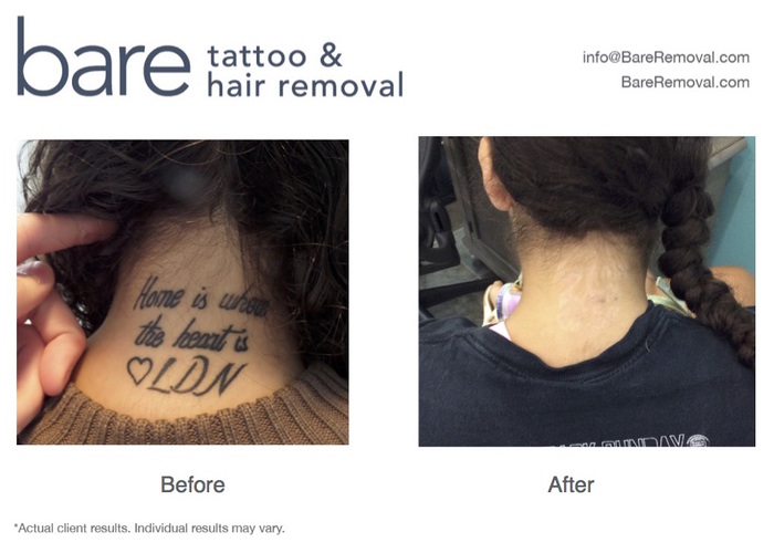  New Album of Bare Tattoo & Hair Removal 2719 North Halsted Street - Photo 3 of 3