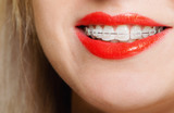 Profile Photos of Moody Orthodontics