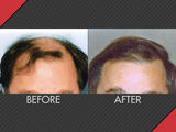  MAXiM Hair Restoration Al-Razi Bldg. 64, Blk. A, Office 2009, Dubai Healthcare City 