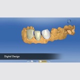 New Album of Dental Crowns Lab