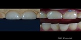 Profile Photos of Dental Crowns Lab Elizabeth