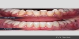 Profile Photos of Dental Crowns Lab Elizabeth