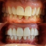 Profile Photos of Smiles On Queen Dentistry