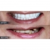 Profile Photos of Dental Crowns Lab