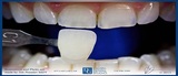 Profile Photos of Dental Crowns Lab